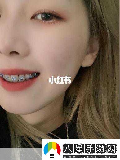 金屬牙套成考場攔路虎