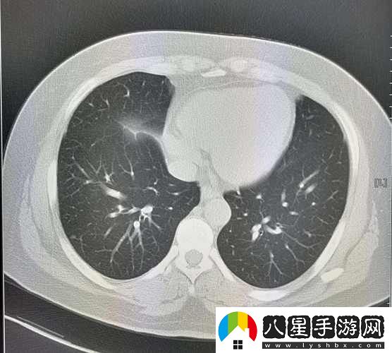 男配每天都在體內成結節(jié)