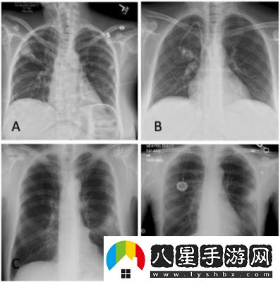 新手必備天天忍者攻略及軍團(tuán)爭(zhēng)霸詳解