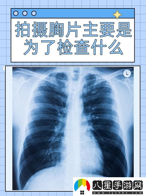 “100%胸片曝光率軟件