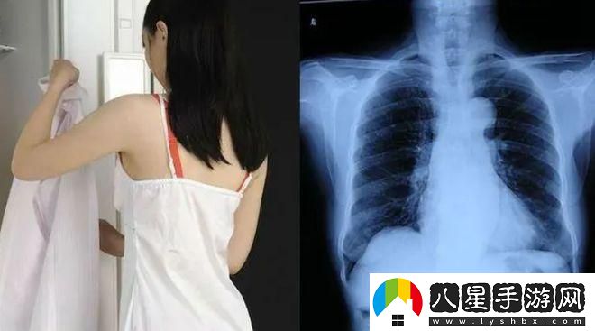 在醫(yī)學(xué)影像中