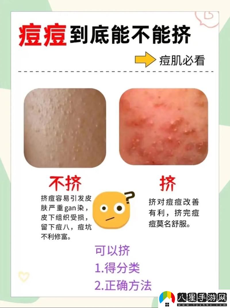 怎樣弄小痘痘才會(huì)渾身酥軟火爆上線