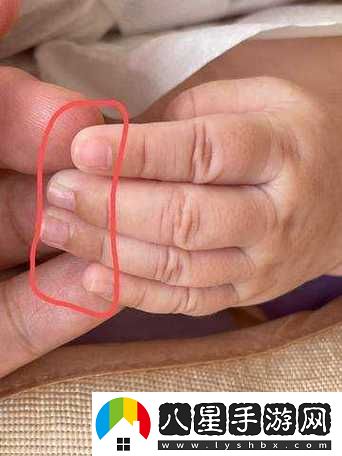 寶寶怎么才三根手指就痛